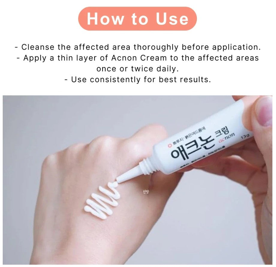 Acnon Cream 13g (Anti-acne)